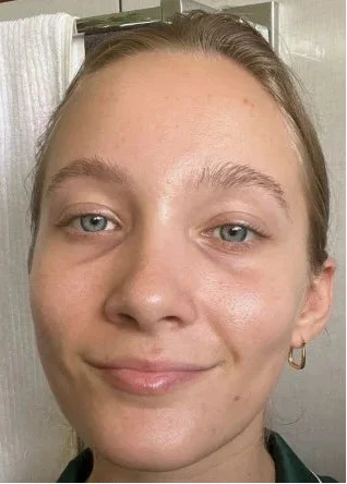 After 1 night